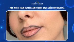 viền môi bị thâm sau khi xăm
