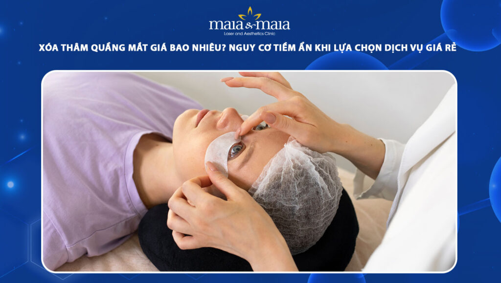 xóa thâm quầng mắt giá bao nhiêu