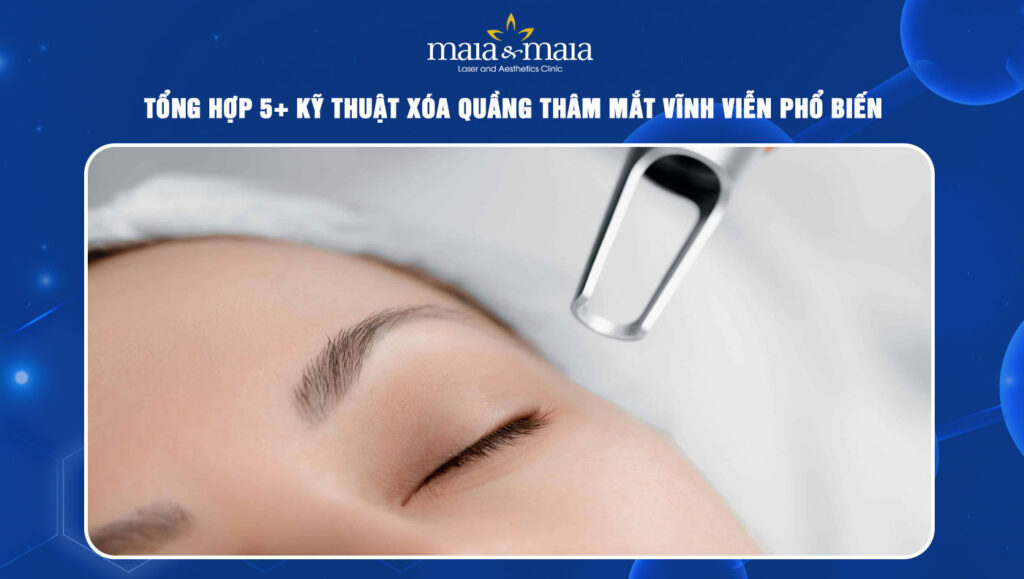 xóa quầng thâm mắt vĩnh viễn