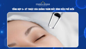 xóa quầng thâm mắt vĩnh viễn