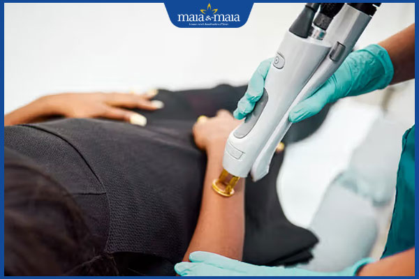 Giải pháp tân tiến xóa vết bỏng bị thâm đen hiệu quả cao 4 xóa thâm bằng công nghệ cao