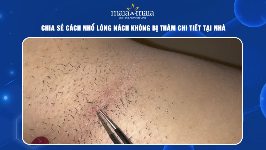 cách nhổ lông nách không bị thâm