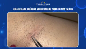 cách nhổ lông nách không bị thâm