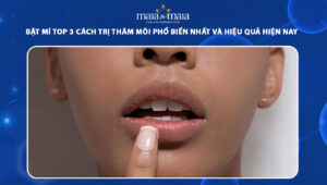 cách trị thâm môi