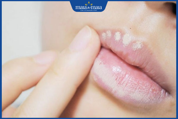 Cách đánh son cho môi thâm lên chuẩn màu và đẹp tự nhiên 3 che khuyết điểm môi