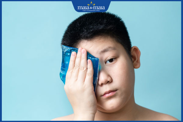 Hướng dẫn làm tan vết bầm tím ở mắt an toàn, nhanh chóng 3 chườm lạnh ở mắt