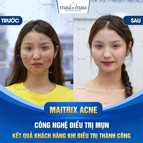 feedback tri rung toc 1