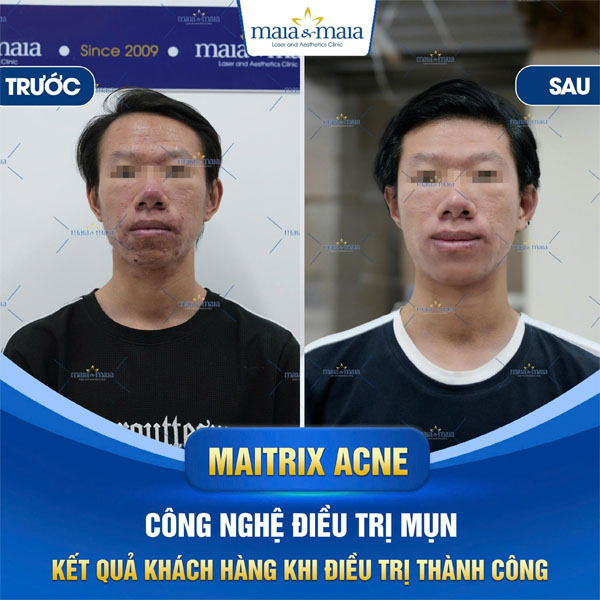 feedback tri rung toc 2