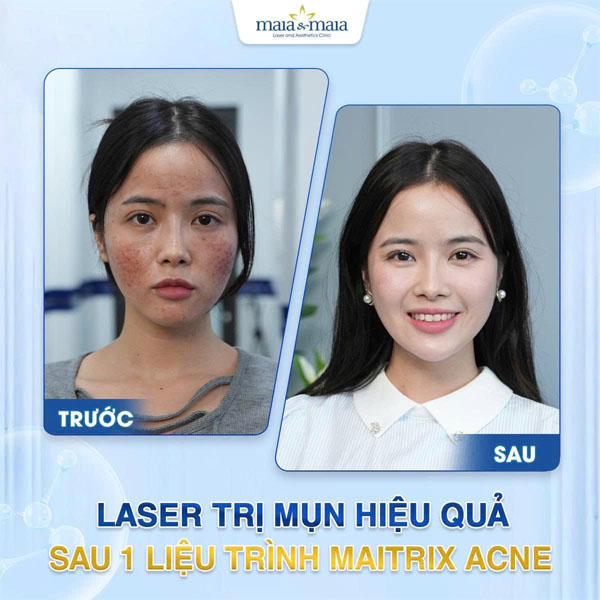 feedback tri rung toc 4