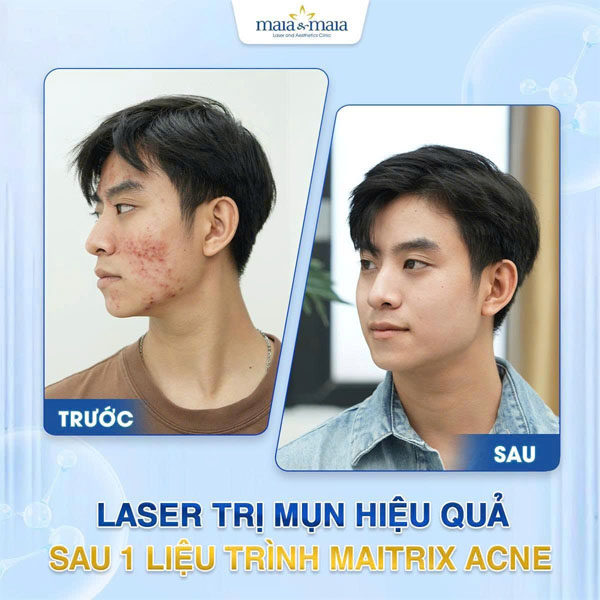 feedback tri rung toc 5