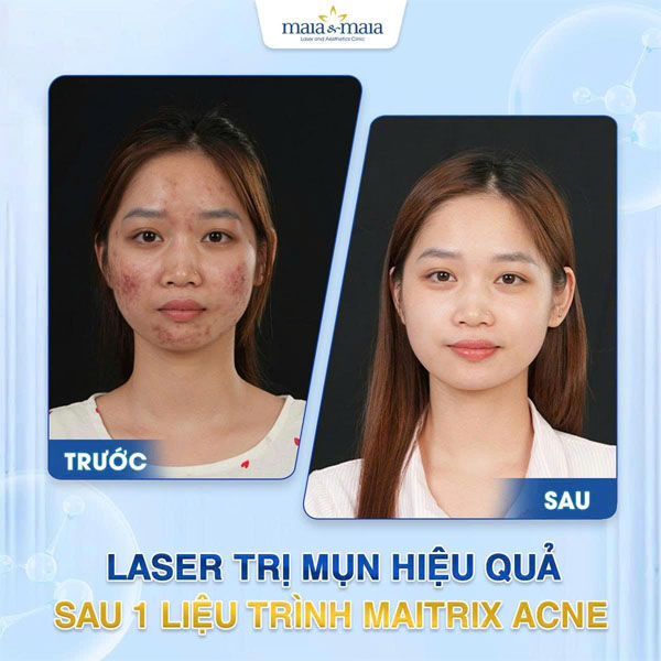 feedback tri rung toc 6