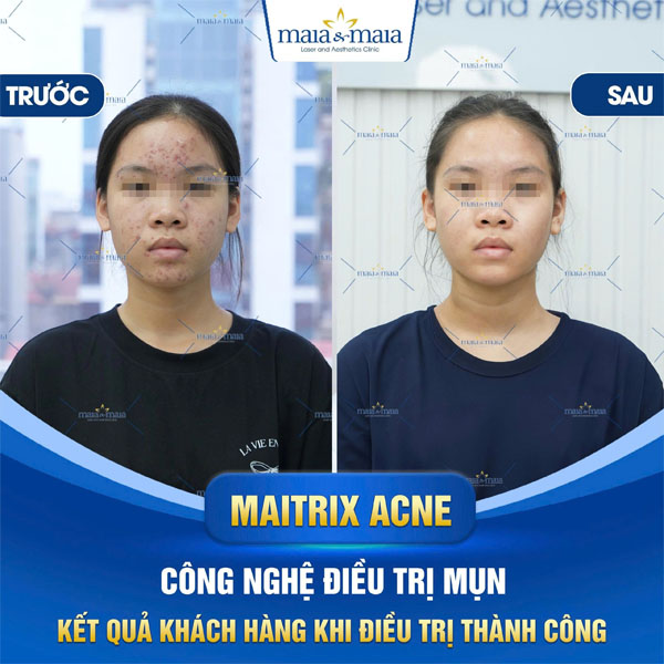 feedback tri rung toc 8