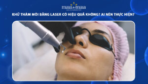 khử thâm môi bằng laser