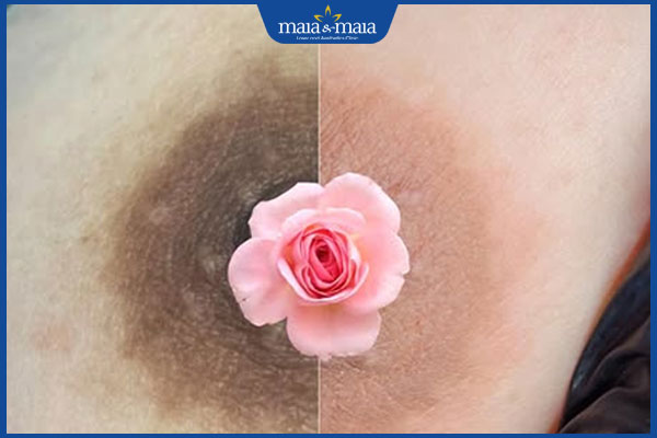 Kem trị thâm nhũ hoa có tốt không? Top 5 sản phẩm hot nhất 6 làm hồng nhũ hoa