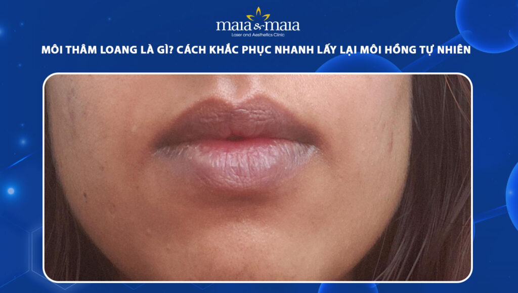 Môi thâm loang là bị sao? Cách lấy lại đôi môi sáng khỏe 1 môi thâm loang