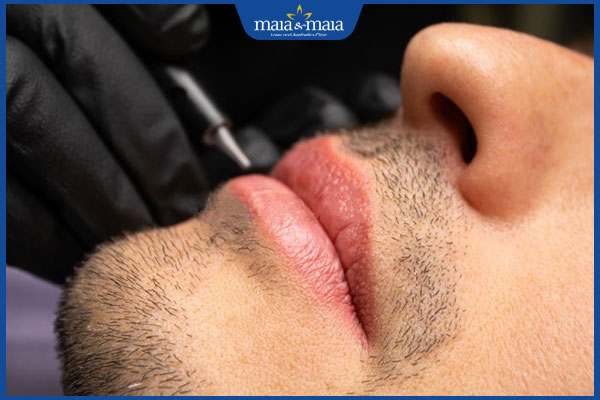 phun môi khử thâm nam