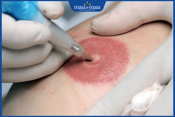 phun nhũ hoa hồng