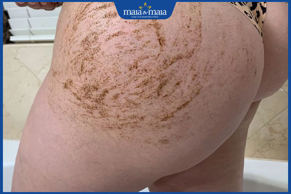 tẩy tế bào chết cho mông