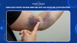 thuốc tan máu bầm