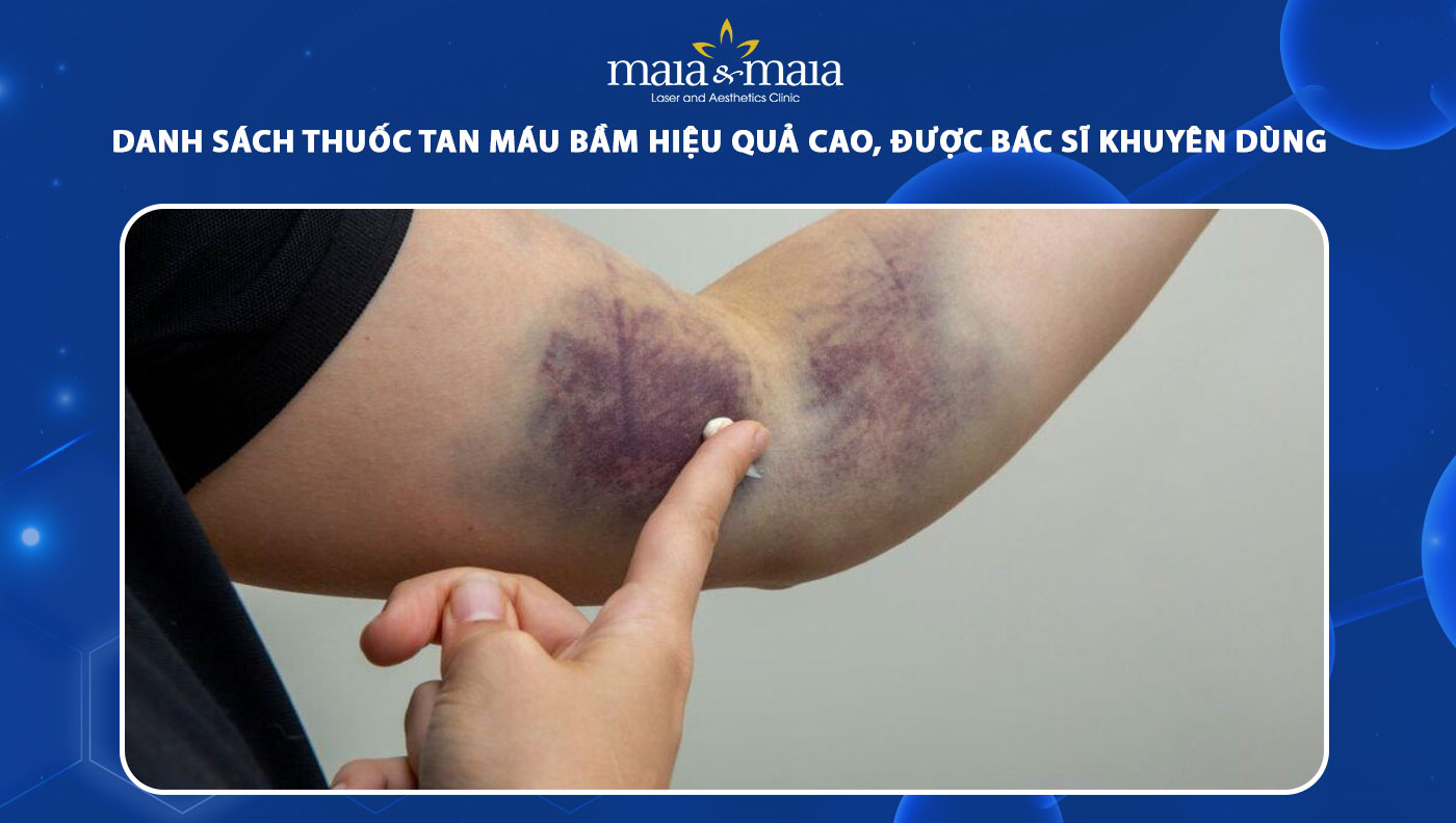 thuốc tan máu bầm