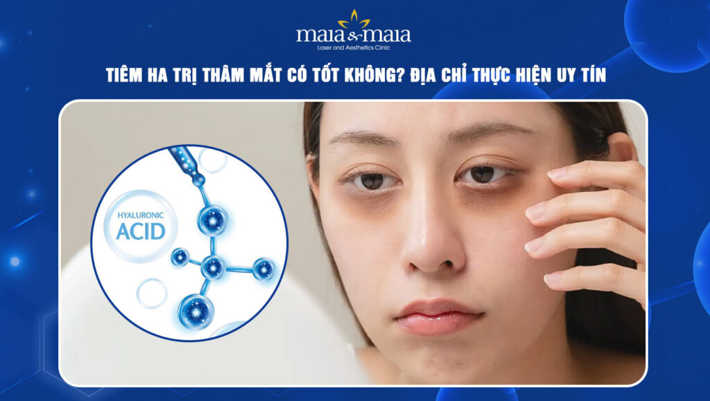 Tiêm HA trị thâm mắt