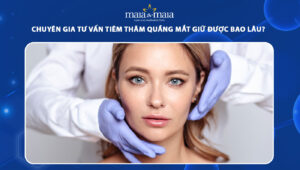 tiêm thâm quầng mắt giữ được bao lâu