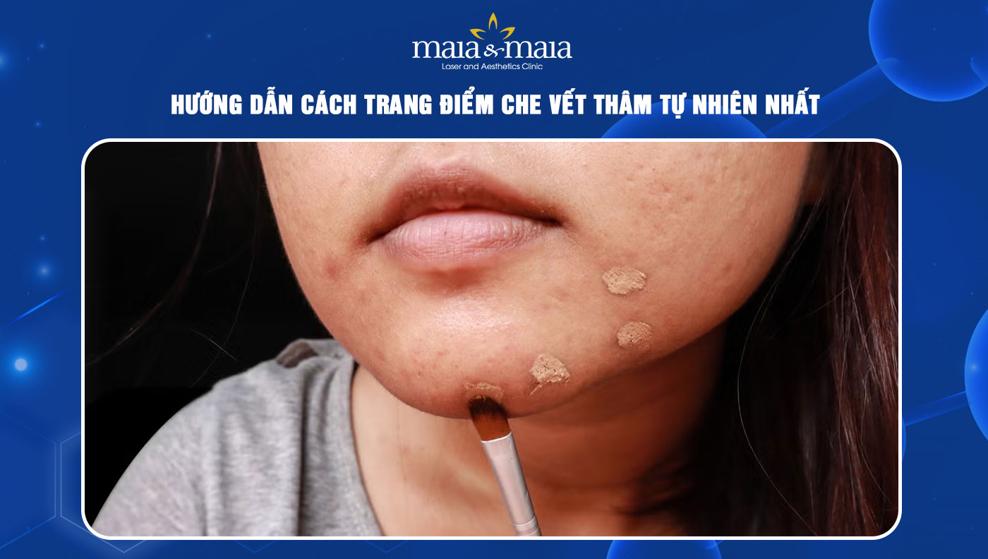 trang điểm che vết thâm