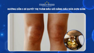trị thâm đầu gối bằng dầu dừa