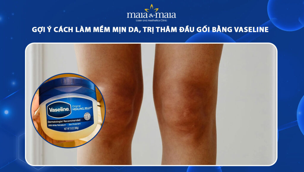 Gợi ý cách làm mềm da, trị thâm đầu gối bằng vaseline 1 trị thâm đầu gối bằng vaseline