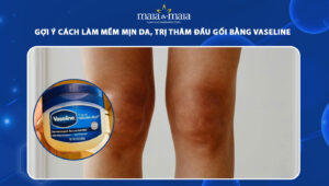 trị thâm đầu gối bằng vaseline