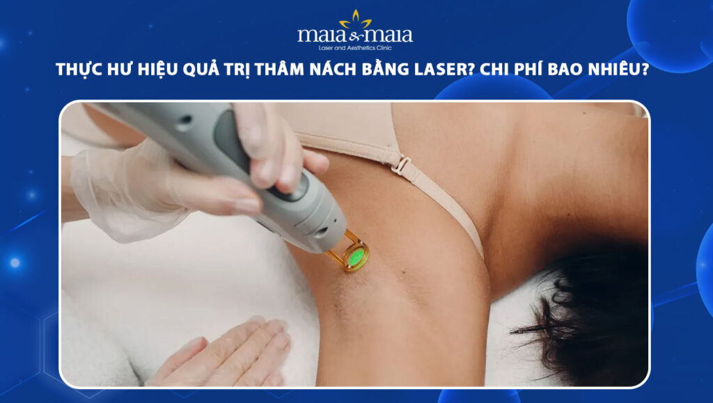 Trị thâm nách bằng laser tốt không? Chi phí bao nhiêu? 1 trị thâm nách bằng laser
