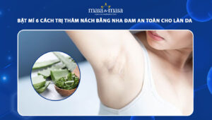 trị thâm nách bằng nha đam