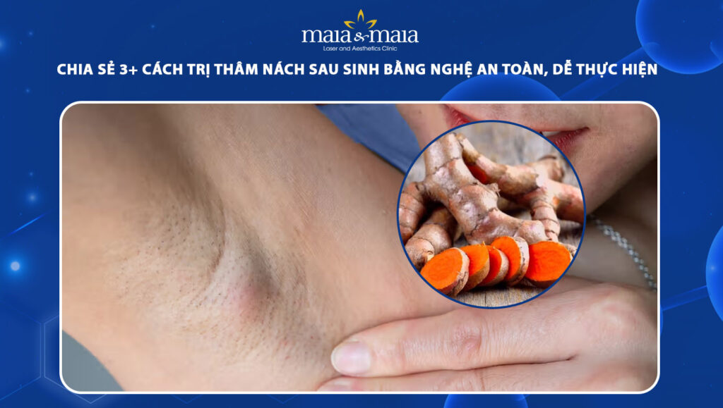 trị thâm nách sau sinh bằng nghệ