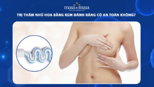 trị thâm nhũ hoa bằng kem đánh răng