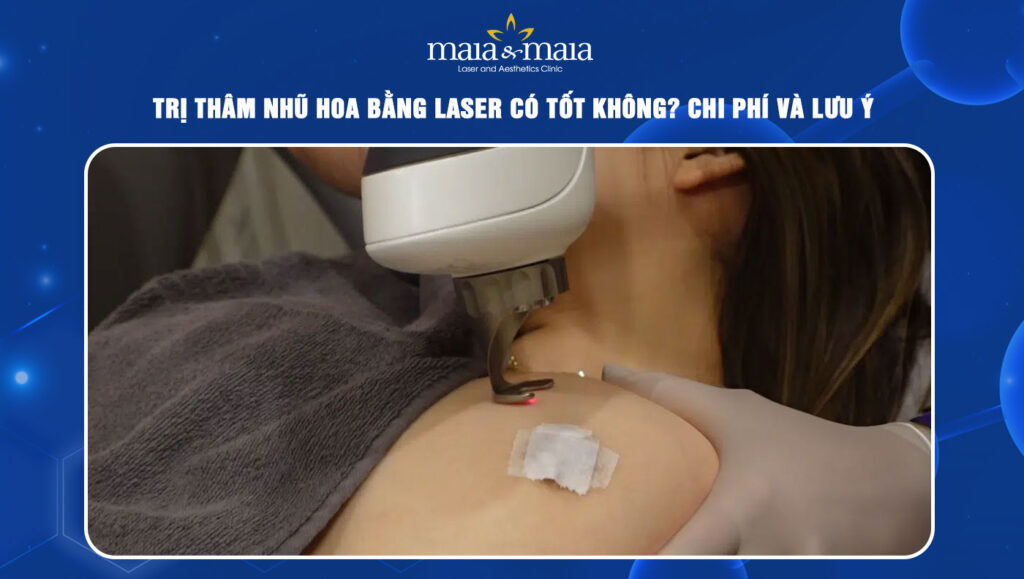trị thâm nhũ hoa bằng laser