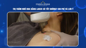 trị thâm nhũ hoa bằng laser