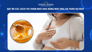 trị thâm nhũ hoa bằng mật ong