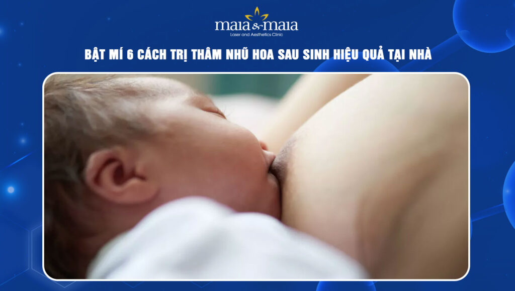 Bật mí 6 cách trị thâm nhũ hoa sau sinh hiệu quả tại nhà 1 Trị thâm nhũ hoa sau sinh