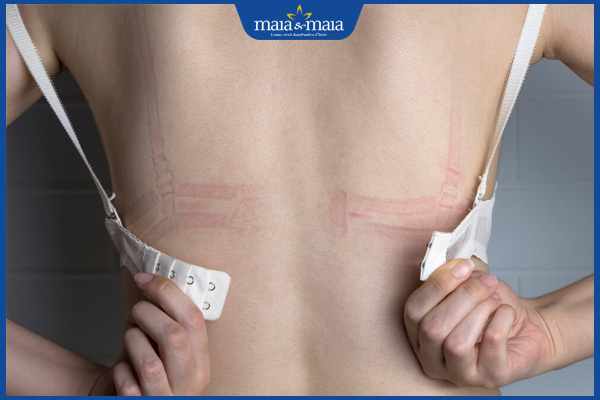 áo ngực quá chật