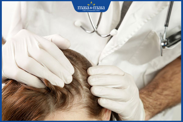 bác sĩ khám nấm da đầu