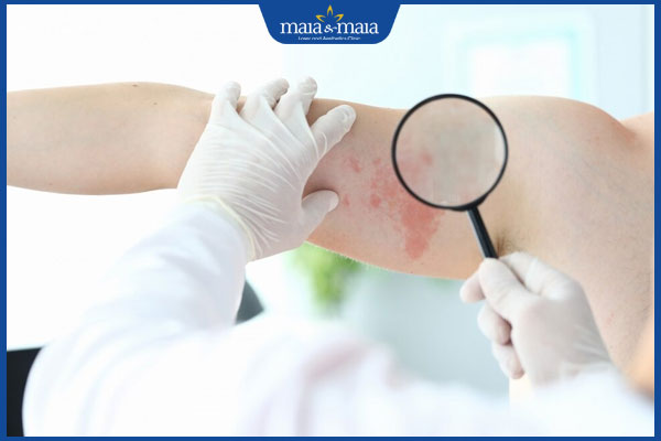 bác sĩ khám nấm da