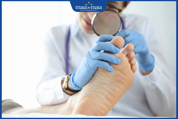 Nấm móng chân có triệu chứng gì? Cách chẩn đoán và điều trị 3 bác sĩ kiểm tra chân