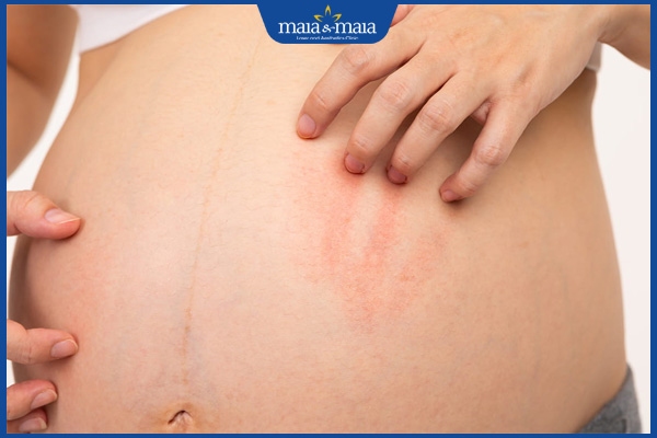 Thuốc bôi ngoài da trị nấm nào tốt? Cách sử dụng hiệu quả 2 bệnh nấm khi mang thai