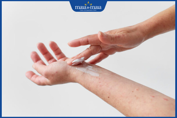 Thuốc bôi ngoài da trị nấm nào tốt? Cách sử dụng hiệu quả 6 bôi thuốc trị nấm da