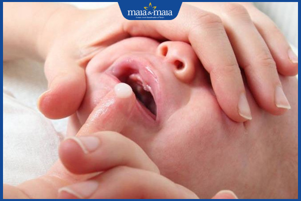 Hướng dẫn cách chữa nấm miệng cho trẻ nhỏ an toàn & hiệu quả 3 bôi thuốc trong miệng cho trẻ