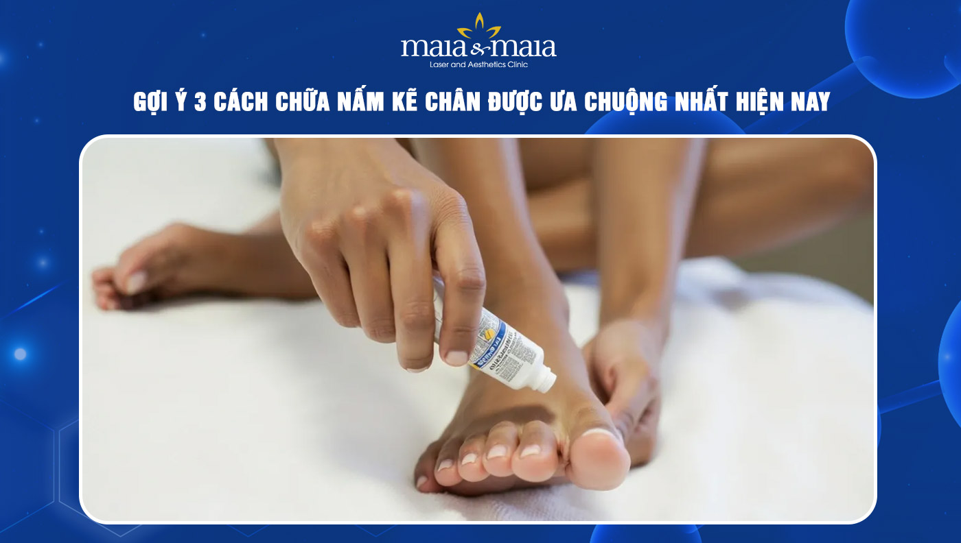 Cách chữa nấm kẽ chân