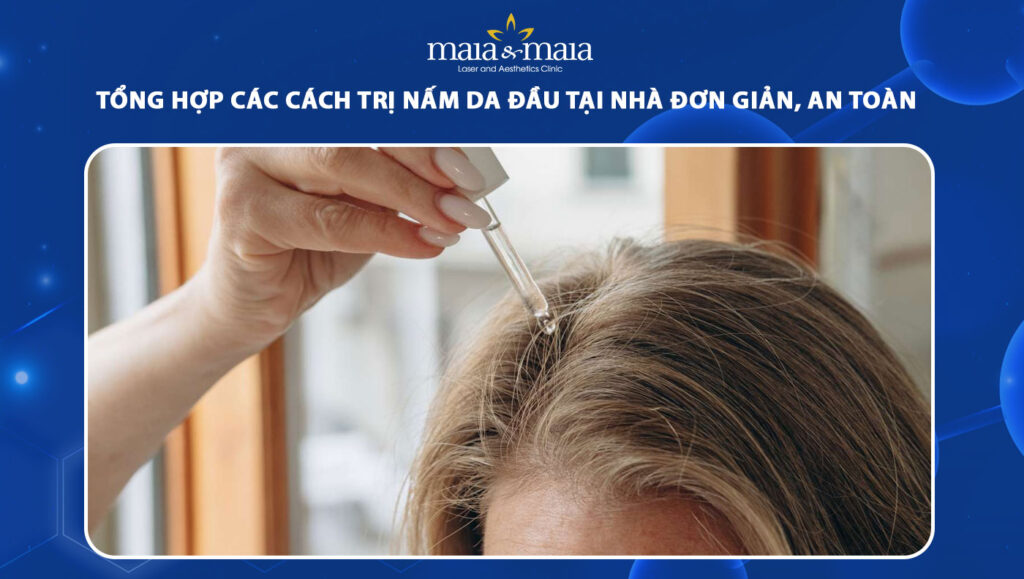 cách trị nấm da đầu tại nhà