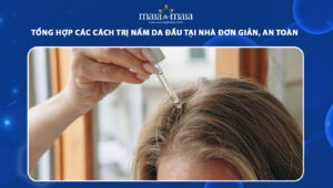 cách trị nấm da đầu tại nhà