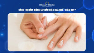 Cách trị nấm móng tay