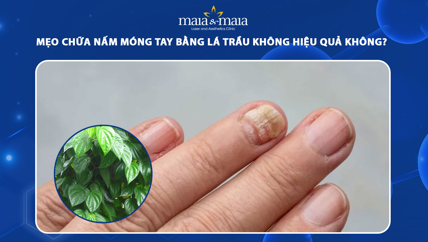 chữa nấm móng tay bằng lá trầu không